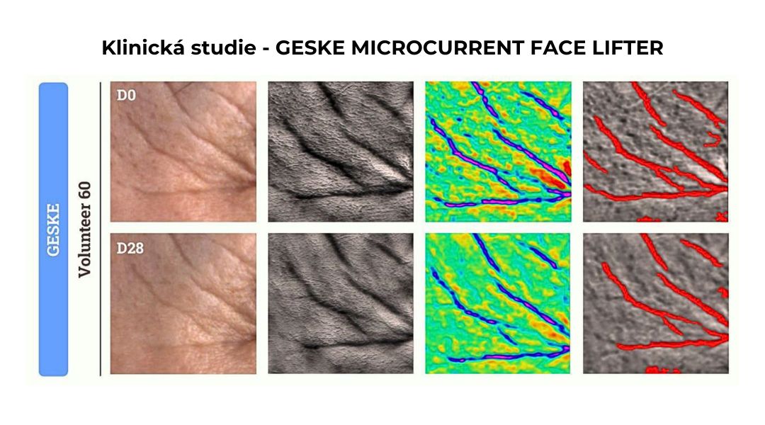 Klinická studie GESKE mikroproudové přístroje